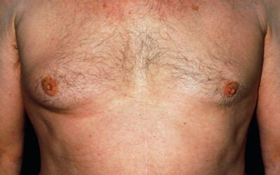 Let’s pink about it before we ignore it!