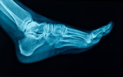 In Case You Missed It: Foot Health